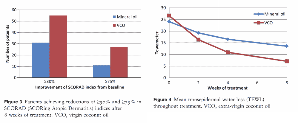 vco-atopic-dermatitis