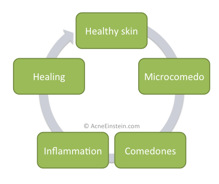 acne-cycle