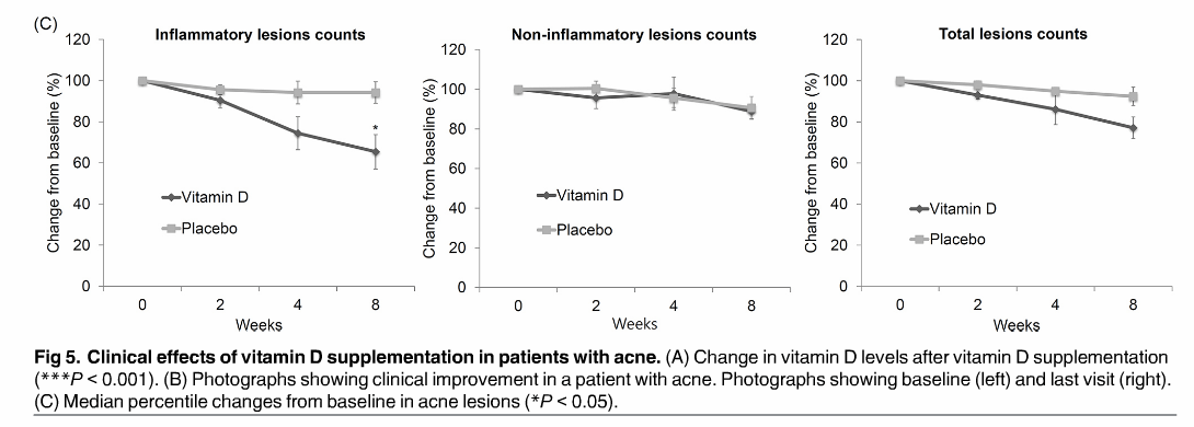 vitamin d supplements acne